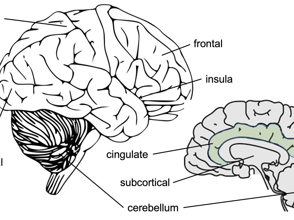brain areas affected by heavy drinking